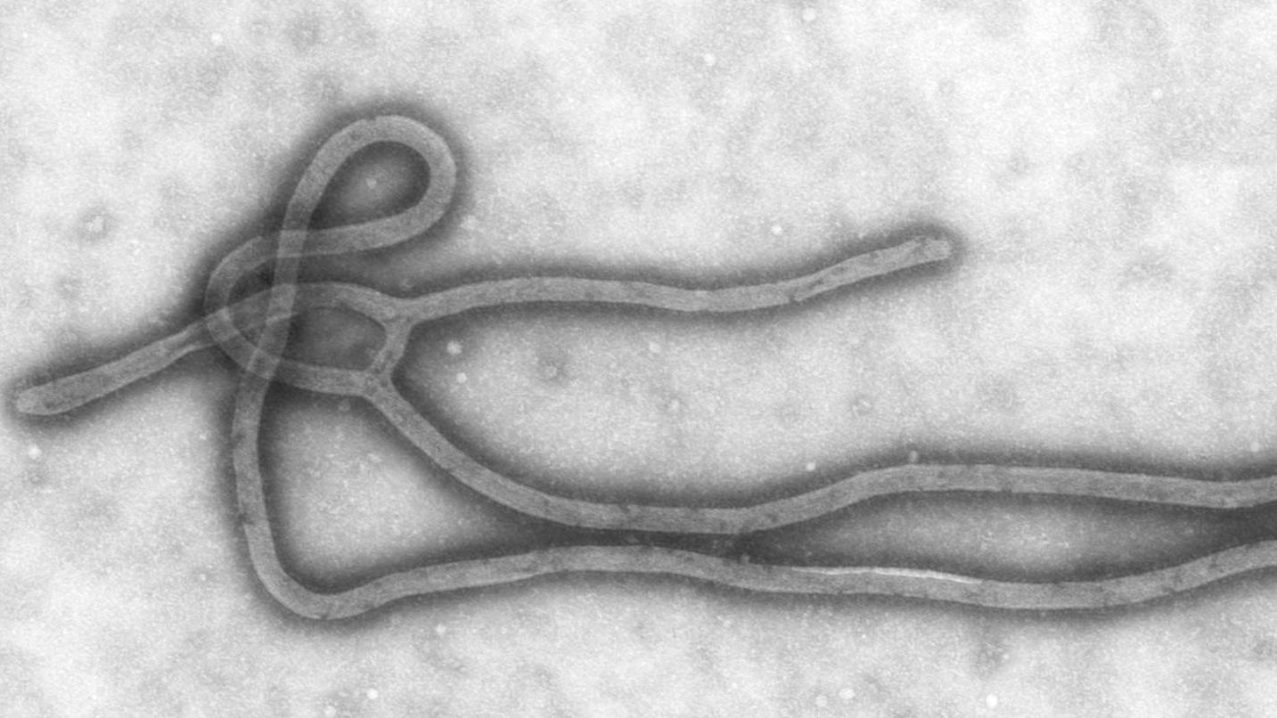 Вирус Эбола