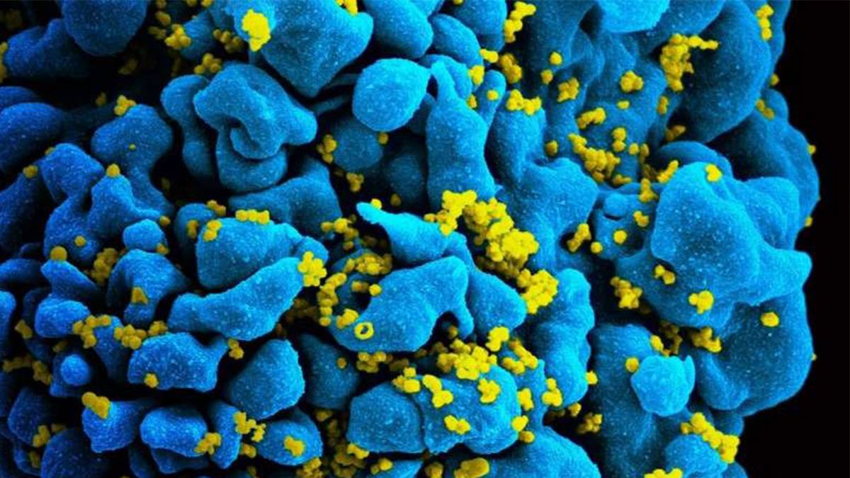 Микрофотография ВИЧ-инфицированной Т-клетки