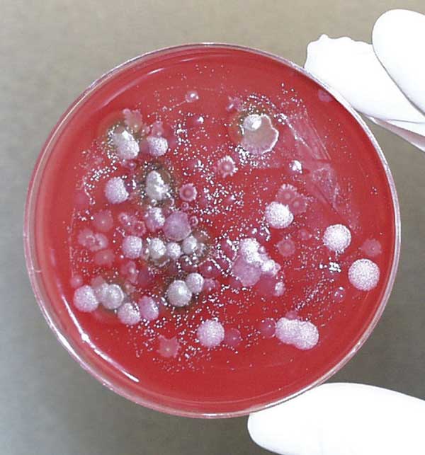 Культура Bacillus anthracis, возбудителя сибирской язвы