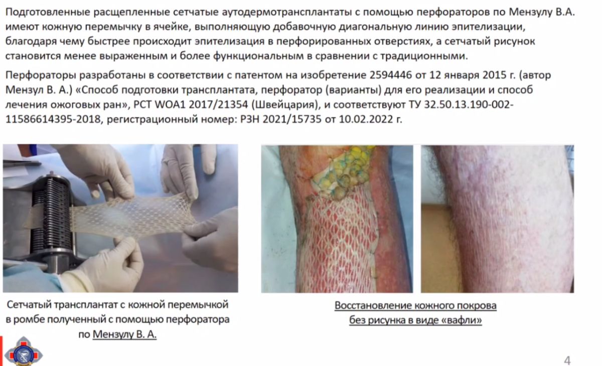 Восстановление кожного покрова