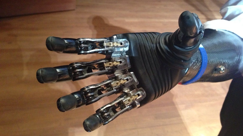 Бионические протезы рук, которые можно приобрести в россии - Орто-Космос