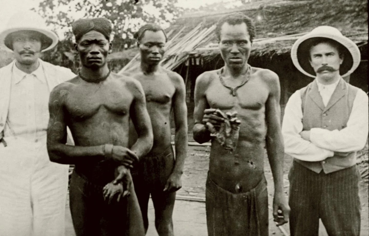 За невыполнение норм колонизаторы отрубали руки жителям Конго. Фото XIX века