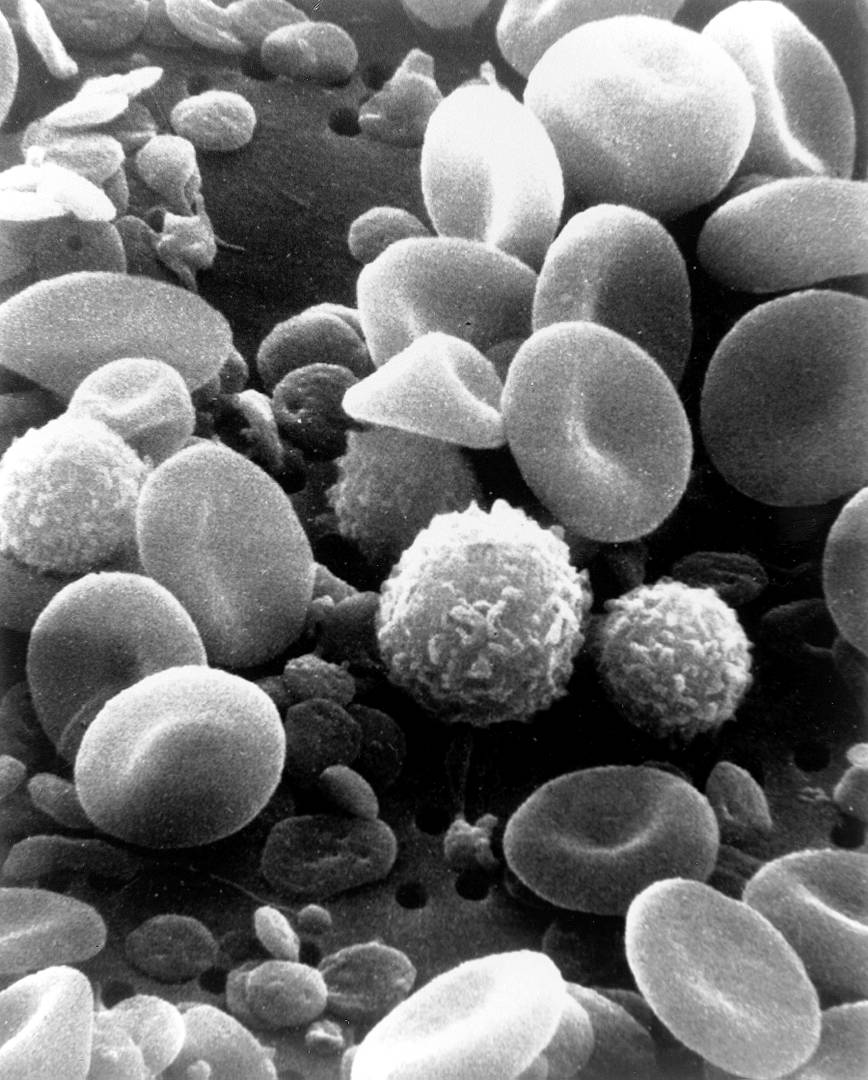 Элементы крови: лейкоциты и эритроциты