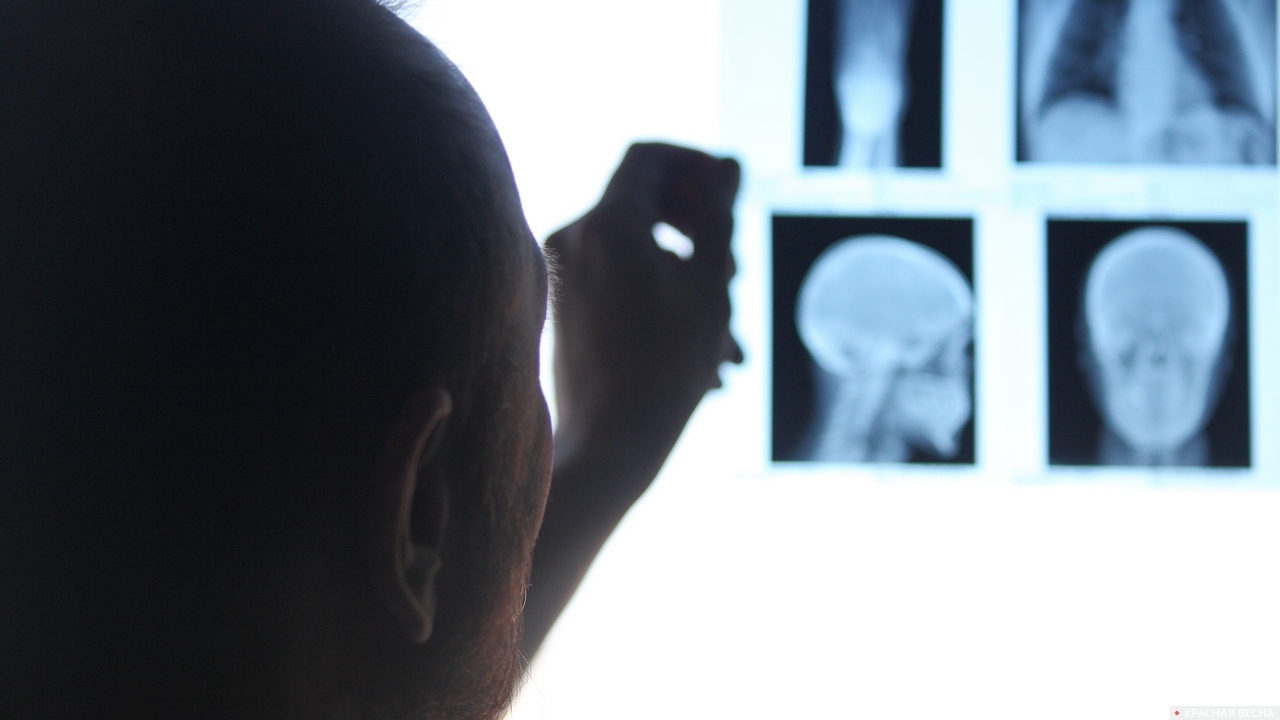 Сотрясение врач. Сотрясение мозга фото на человеке. Сотрясение мозга снимок рентген 5 лет.