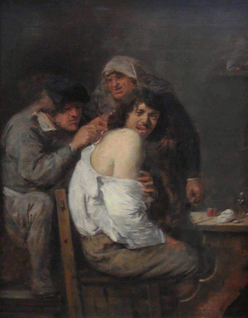 Адриан Браувер. Операция на спине. Около 1636