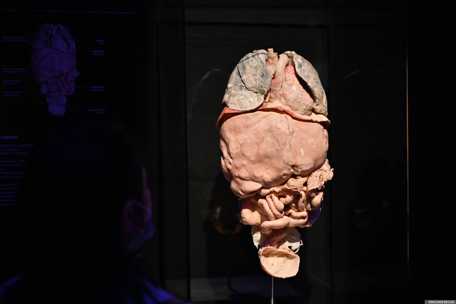 Выставка Body worlds. Мир тела. Анатомическая выставка ВДНХ