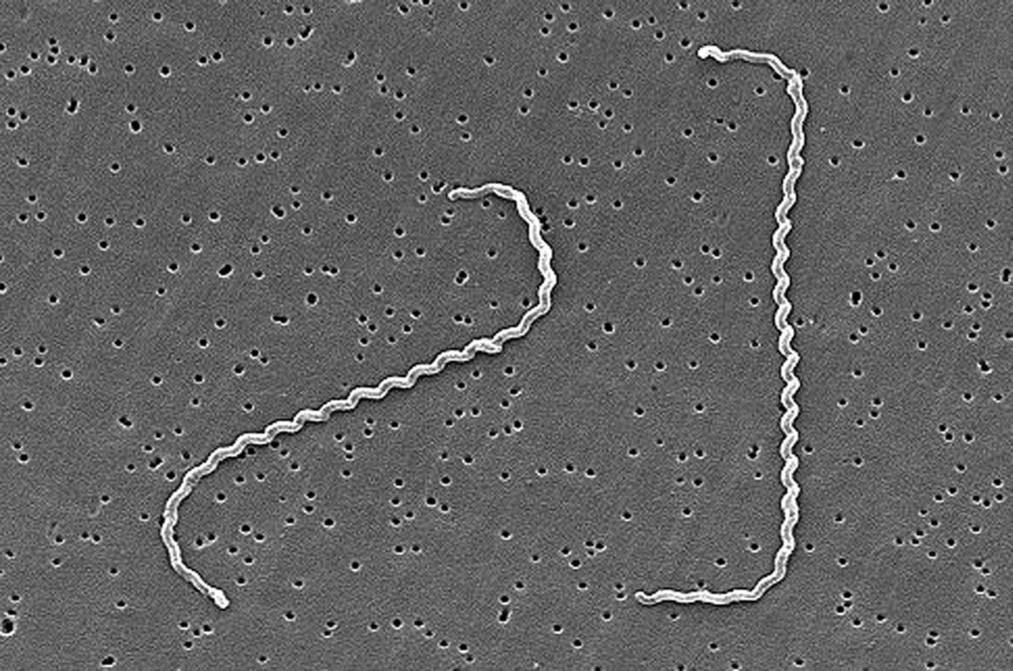 Бактерия Leptospira interrogans, возбудитель лептоспироза