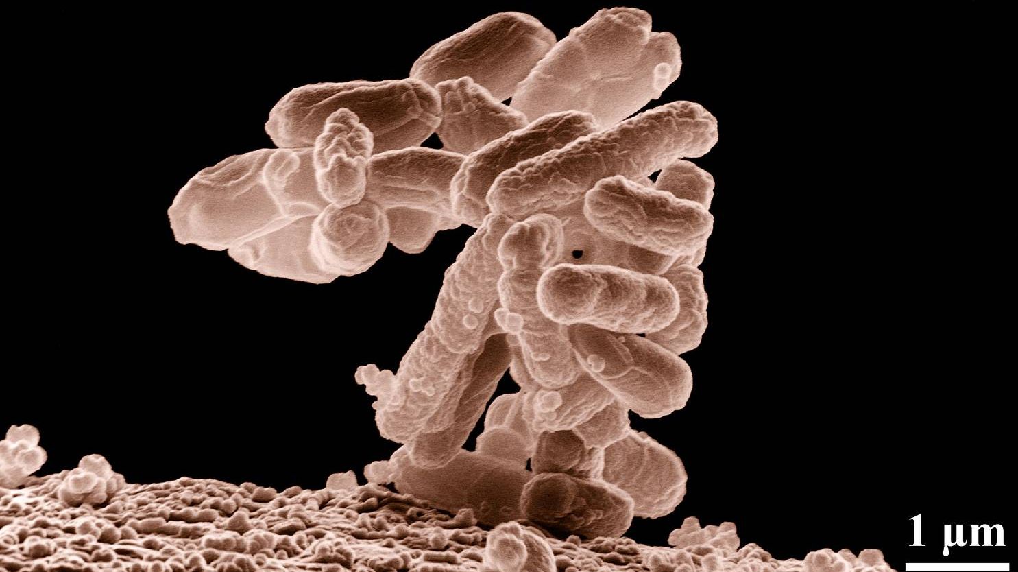Патогенная бактерия E. coli (электронная микрофотография)