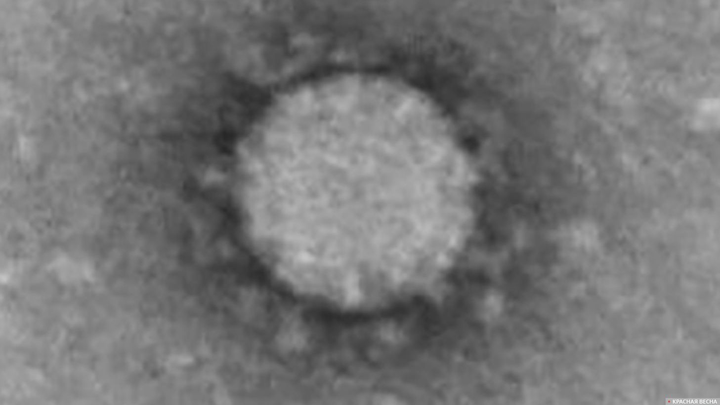 Снимок коронавируса SARS-CoV-2