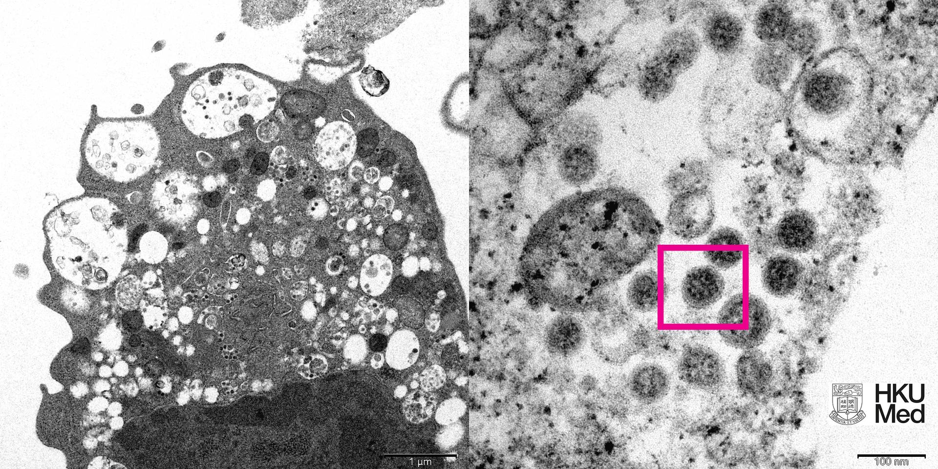 Микрофотографии штамма коронавируса «Омикрон»