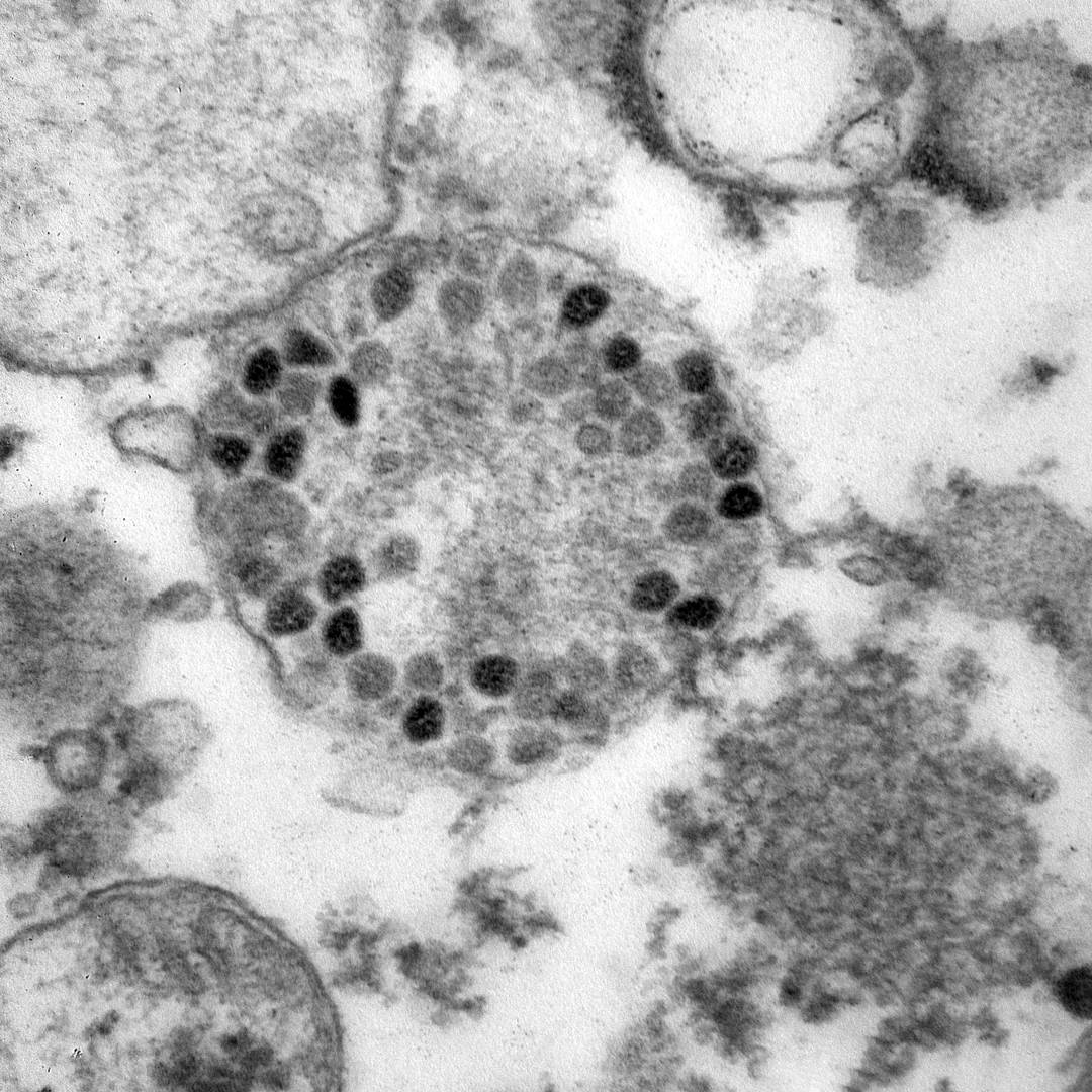 Фотография штамма коронавируса «Омикрон»