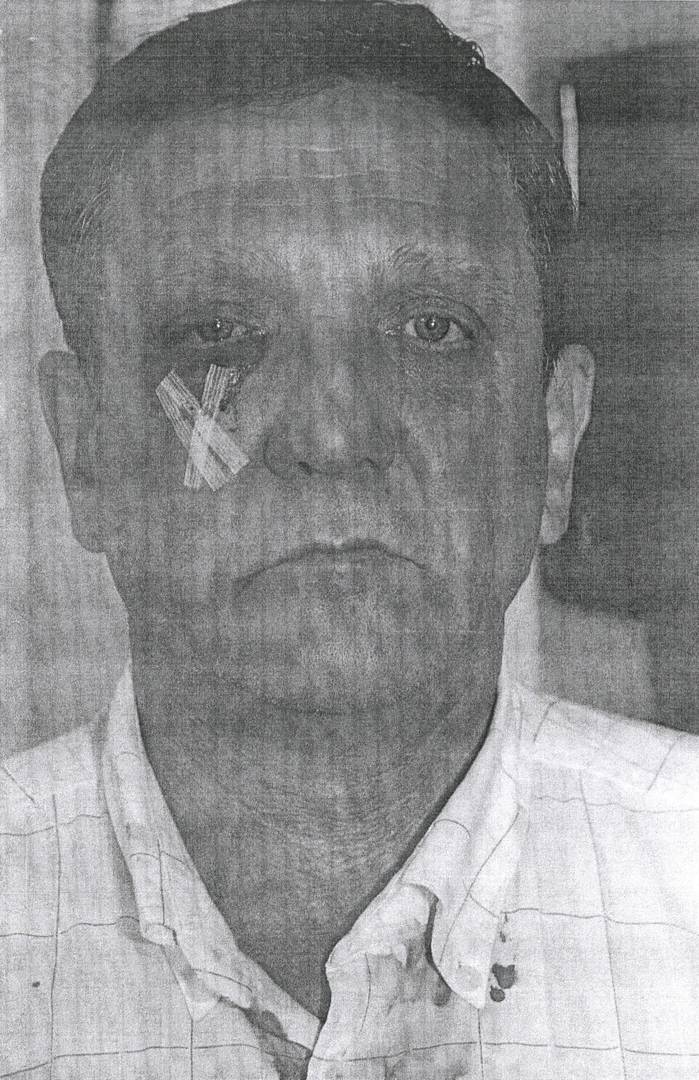В. И. Терлюк после нападения в 2010 году.