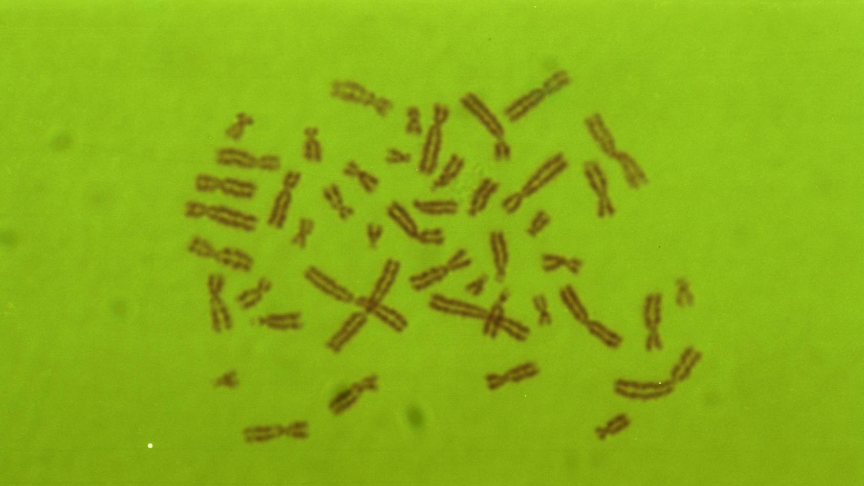 Хромосомный набор (кариотип) человека