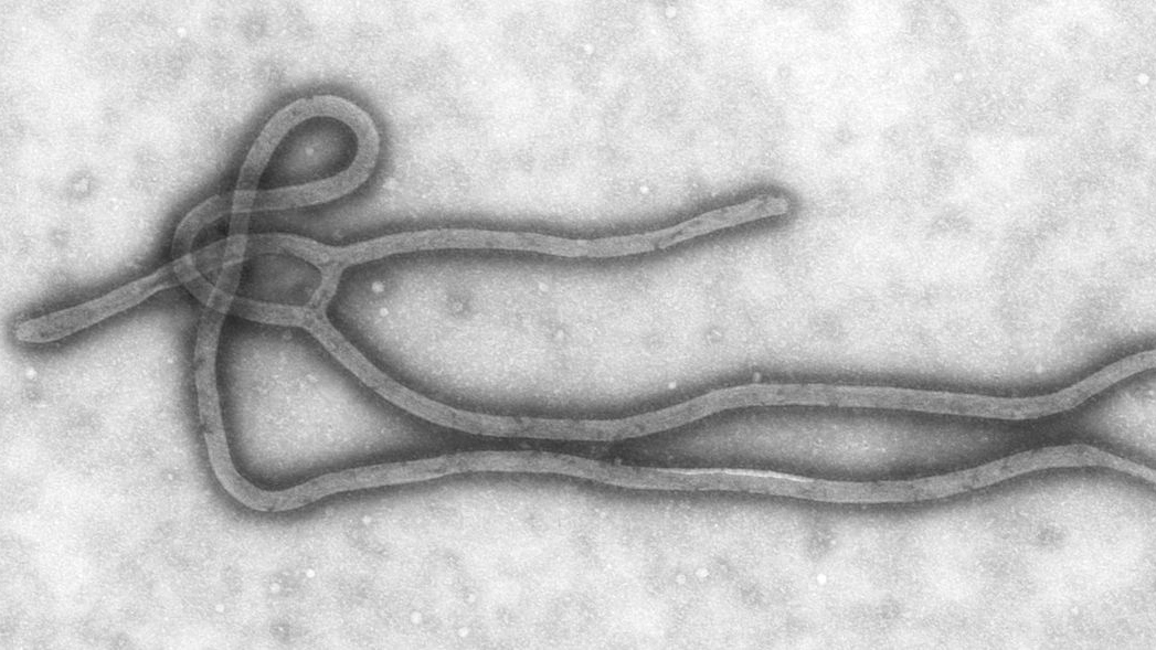 Изображение вируса Эбола, полученное с помощью просвечивающей электронной микроскопии