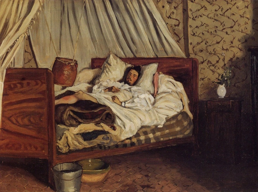 Фредерик Базиль. Импровизированный госпиталь. Моне после несчастного случая в Шайи. 1865