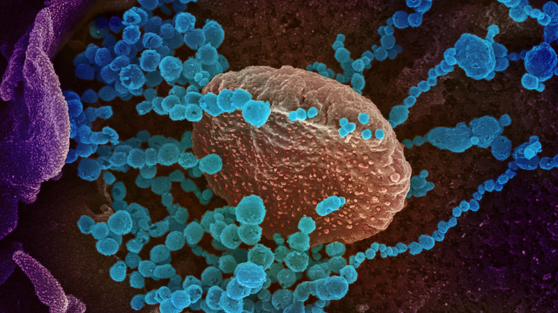 Коронавирус, фотография через электронный микроскоп