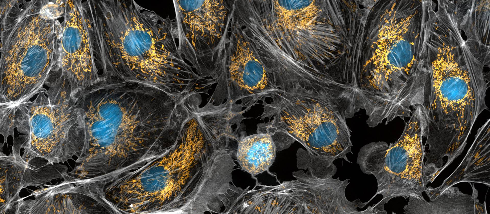Фотография коровьих клеток, сделанная под микроскопом. Митохондрии окрашены в ярко-желтый цвет. Большие синие точки — это ядра клеток, а серая паутина — их цитоскелет.