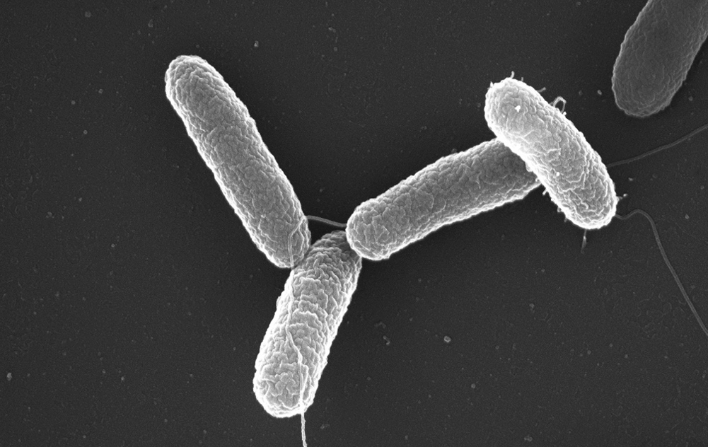 Возбудитель сальмонеллеза (Salmonella typhimurium). Микрофотография