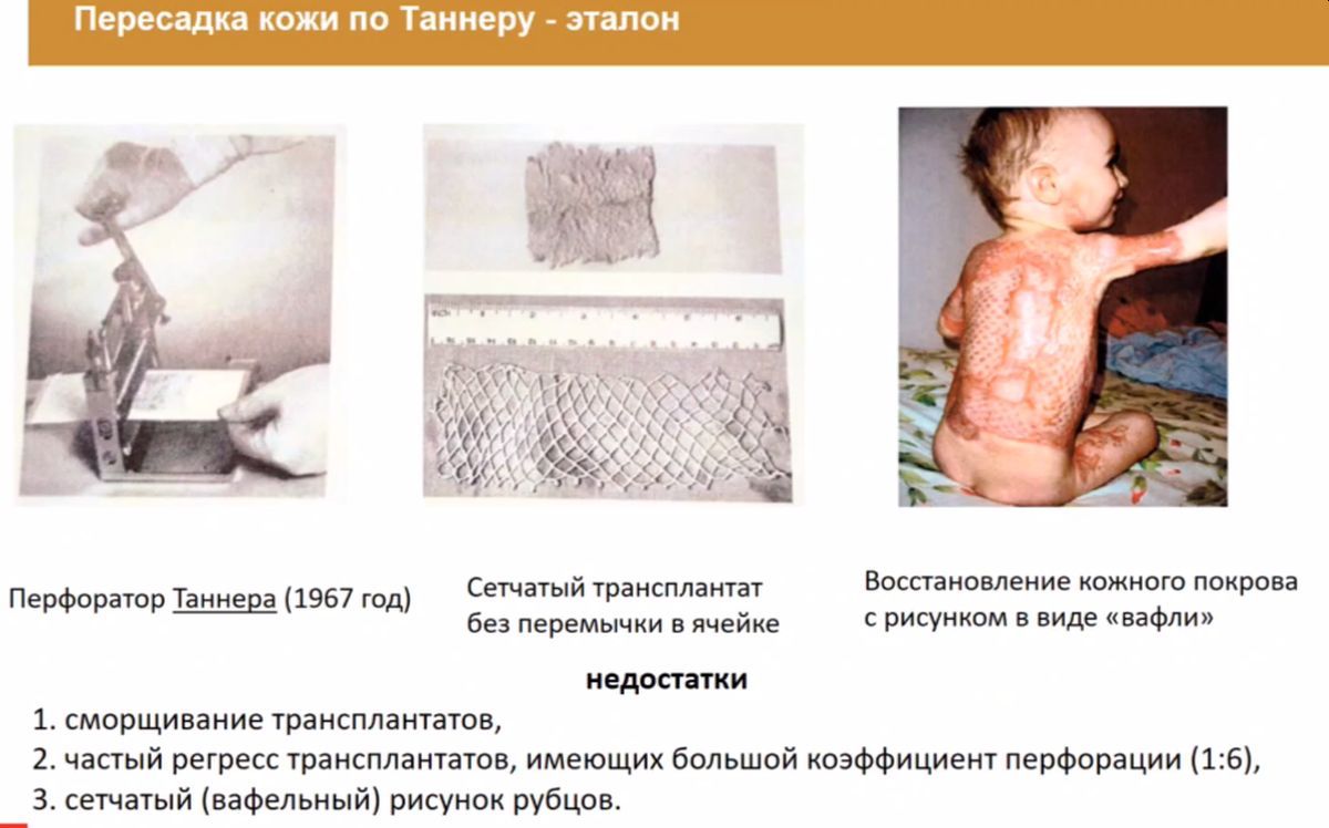 Перфоратор Таннера