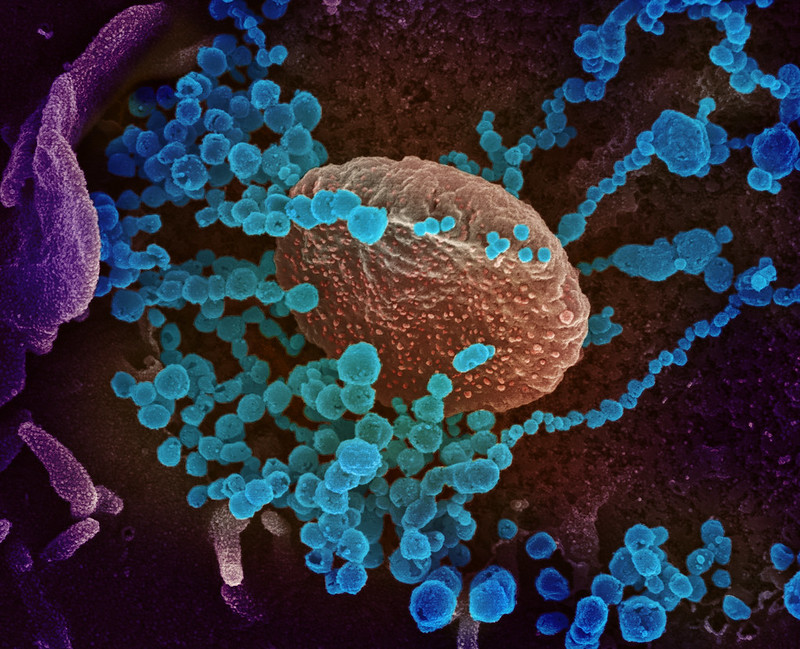 Коронавирус, фотография электронным микроскопом