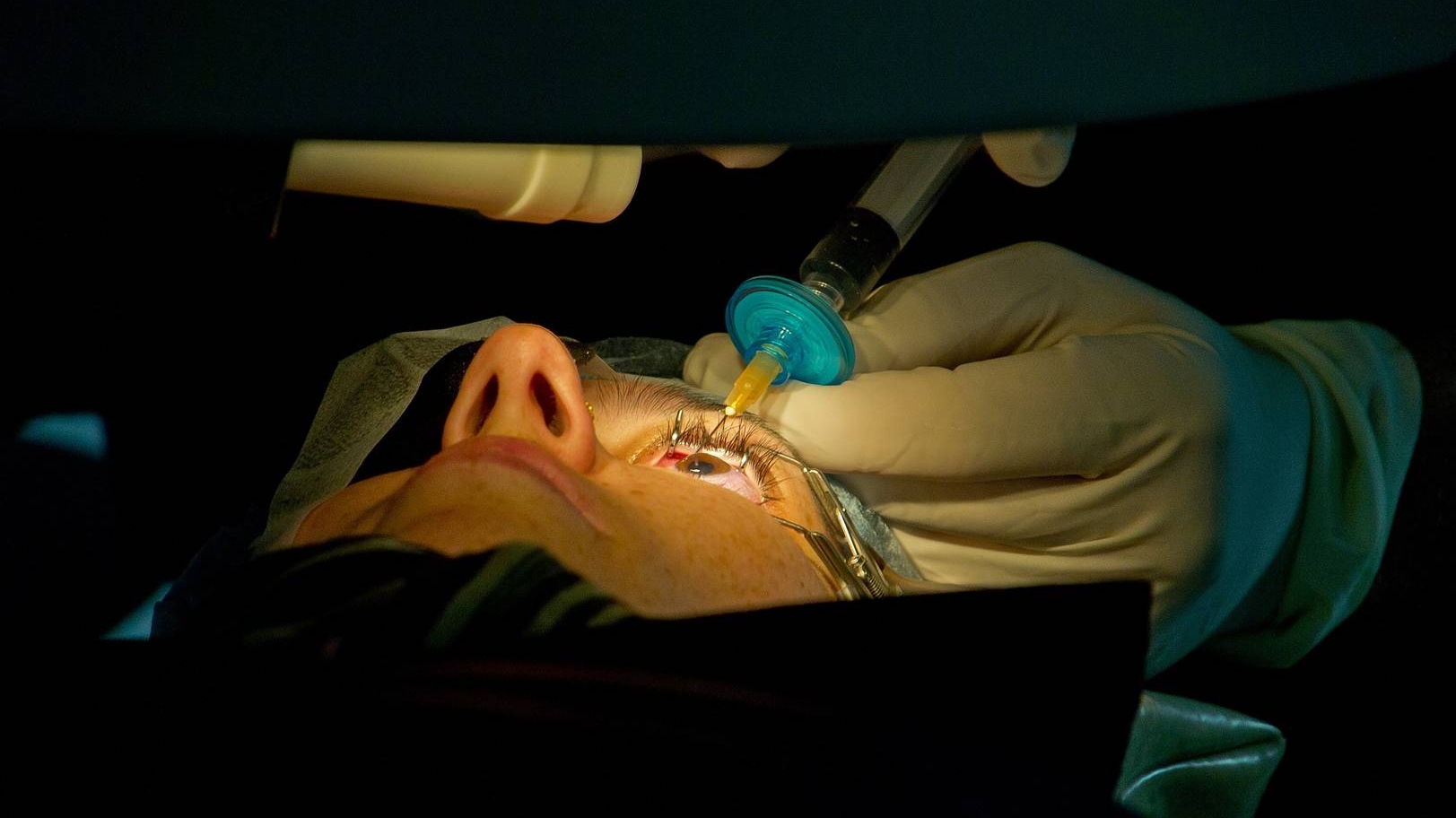 Офтальмологическая операция