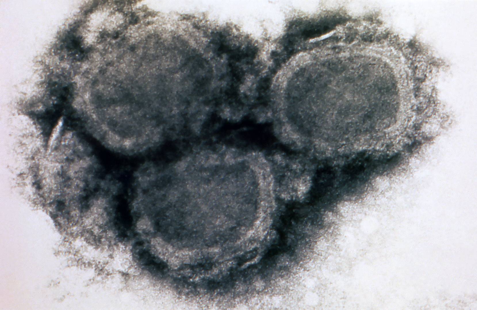 Три вирусные частицы натуральной оспы под электронным микроскопом