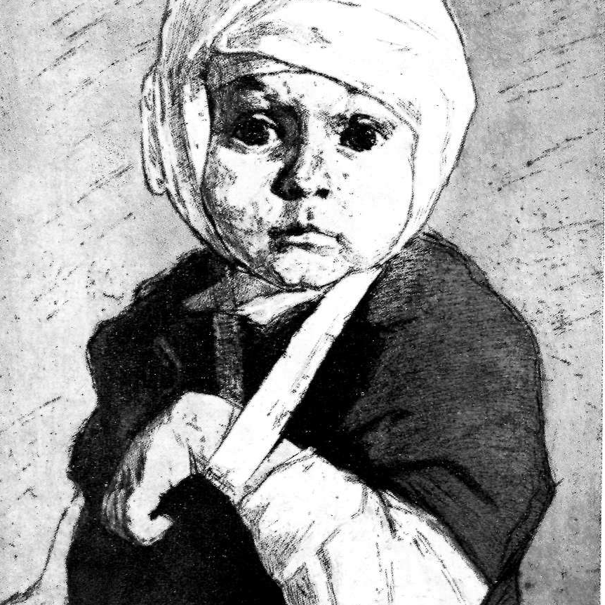 Харшак Александр Исаакович. Раненный ребёнок. 1947 (фрагмент)