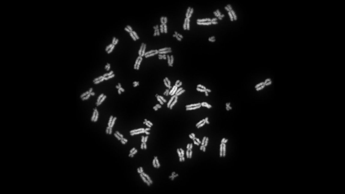 Митотические хромосомы человека