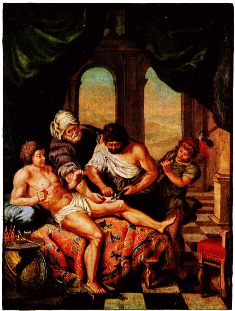 Неизвестный мастер «Лечение раны копьем» Вторая половина XVII века (Земмельвейсский музей истории медицины, Будапешт)