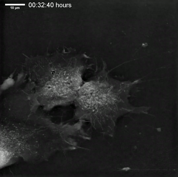 Пример мезенхимальных стволовых клеток человека, полученных с помощью микроскопа для визуализации живых клеток