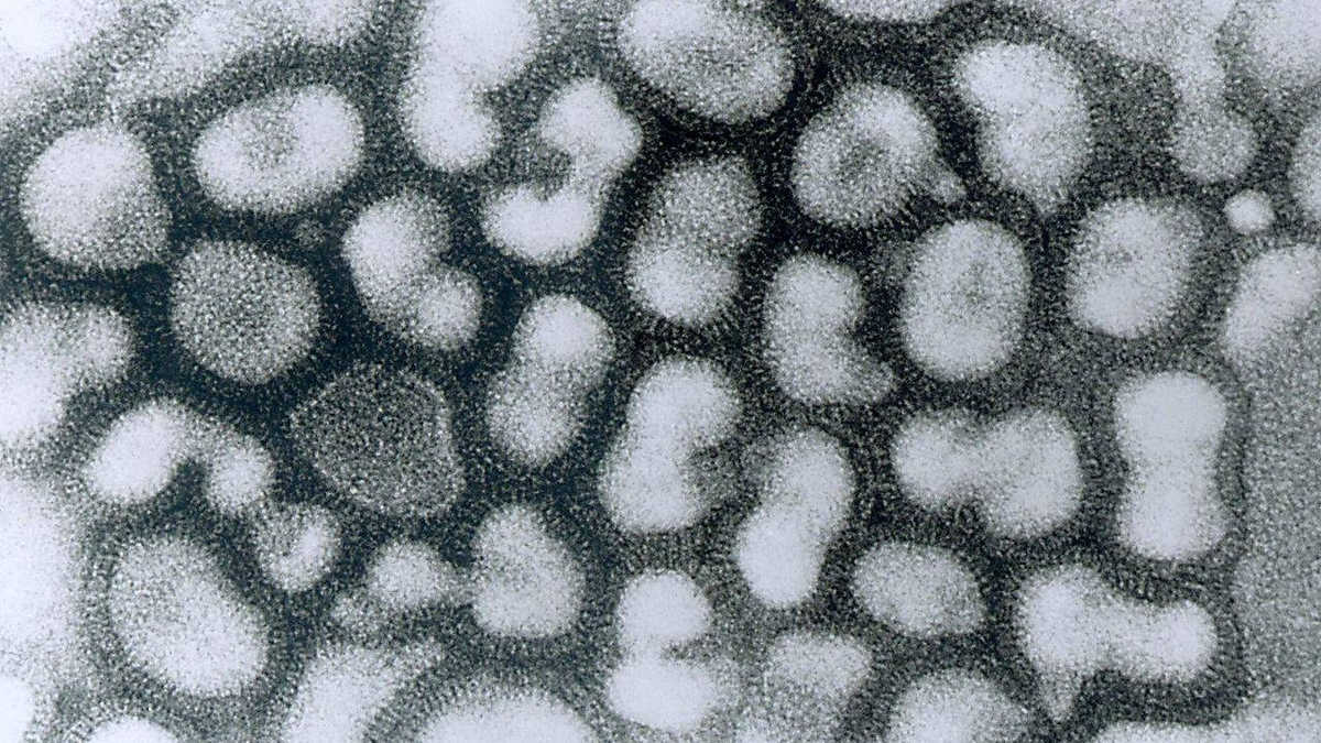 Вирус птичьего гриппа. Электронная микрофотография