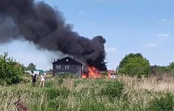 Ожоги паром и первая помощь в домашних условиях