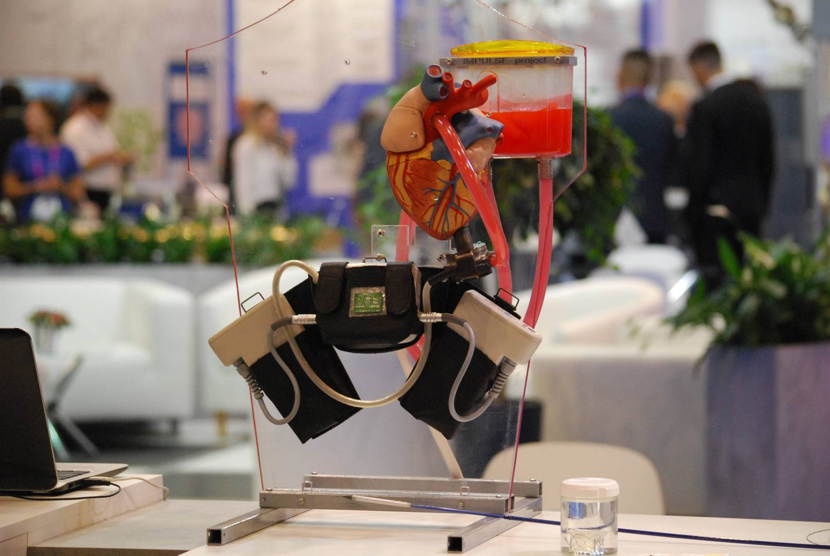 Робот провел операцию. Робот из Новосибирска. Робот провел операцию на сердце. Сердце робота. Роботизированная магнитная навигационная система Niobe (Stereotaxis, США).