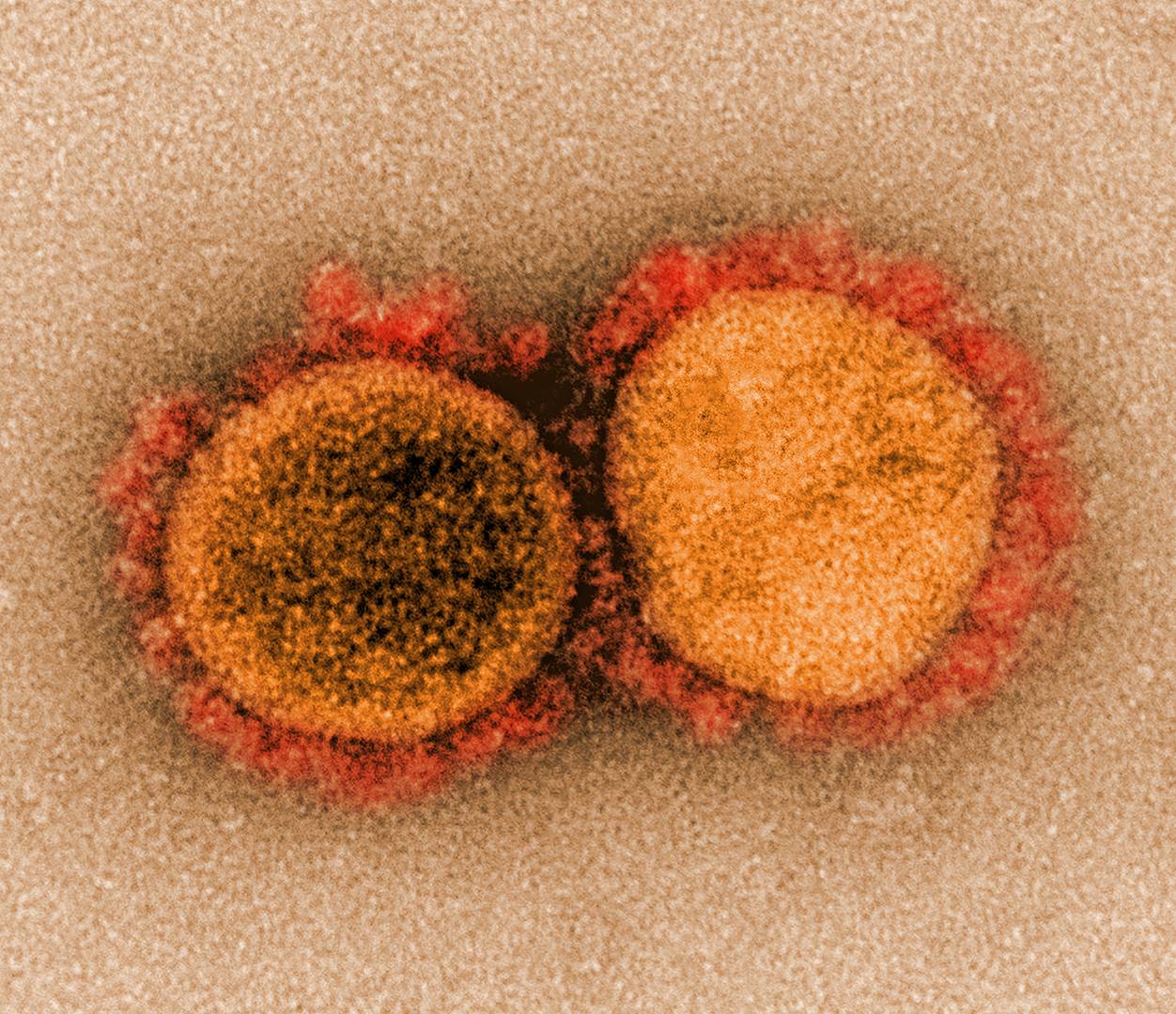 Изображение SARS-CoV‑2, полученное с помощью просвечивающей электронной микроскопии в Национальном институте аллергии и инфекционных заболеваний в Форте Детрик