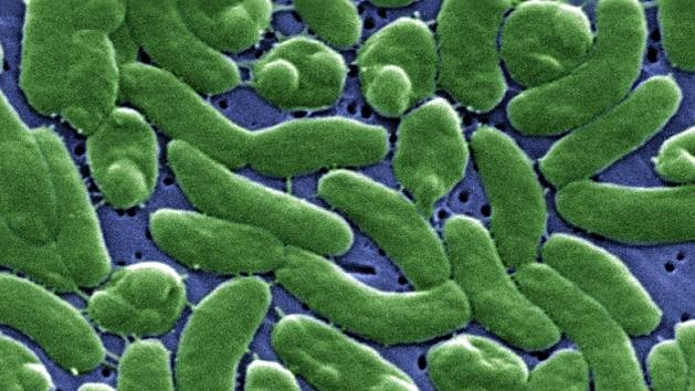 Электронная микрофотография бактерии Vibrio vulnificus